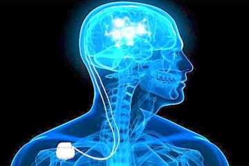 addiction recovery ebulletin deep brain stimulation