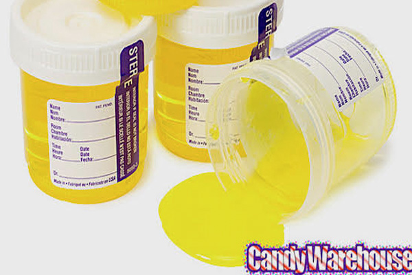 addiction recovery ebulletin candy urine